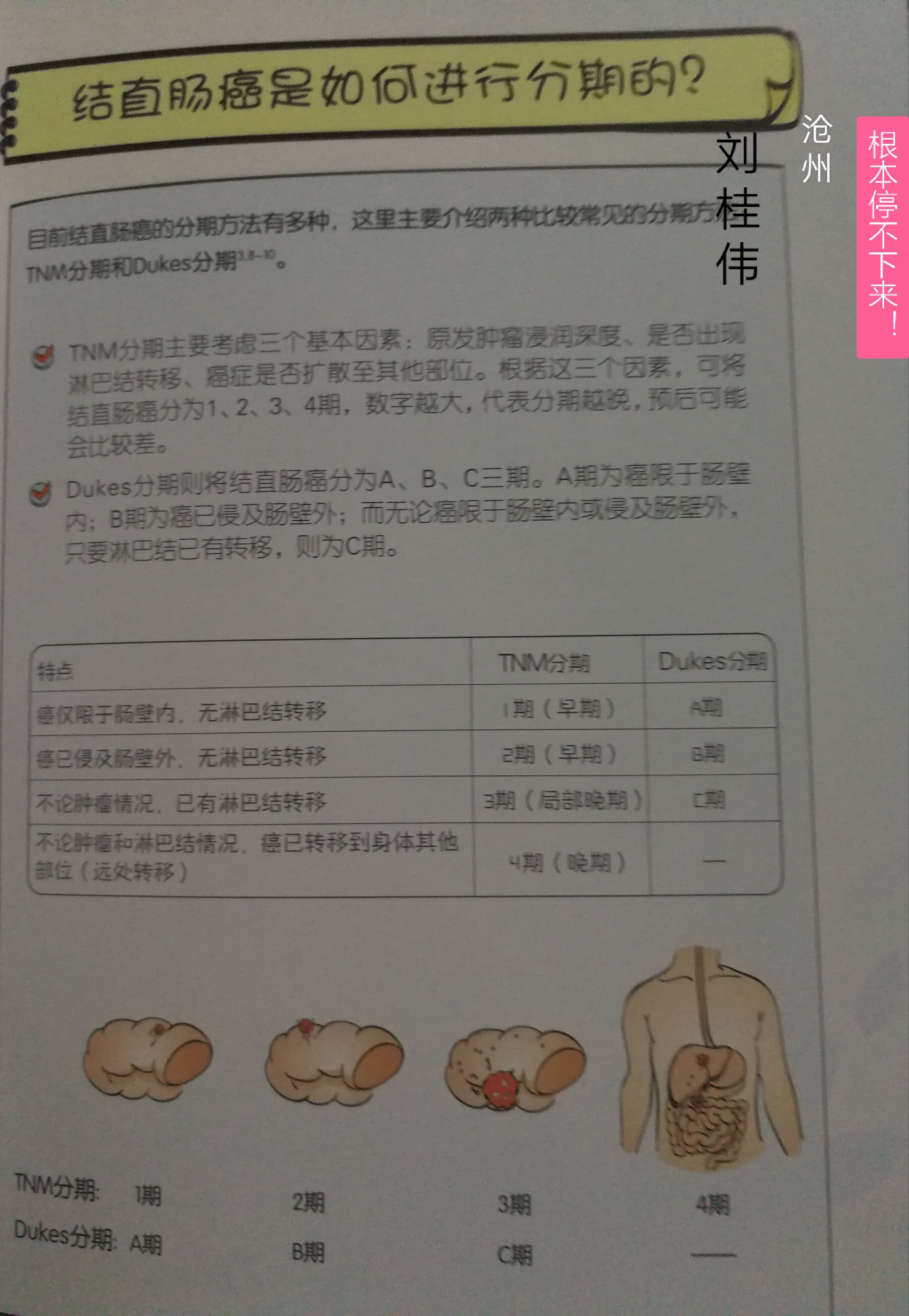 最新直肠癌分期研究，揭示临床意义的深度洞察